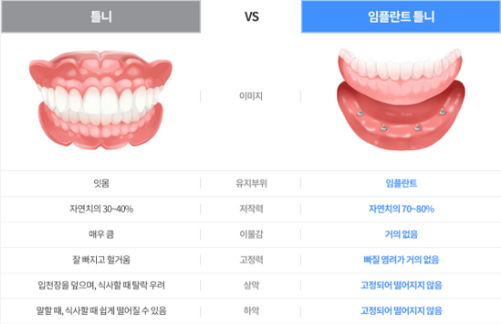 틀니 vs 임플란트: 2024년 가격 비교와 선택 가이드